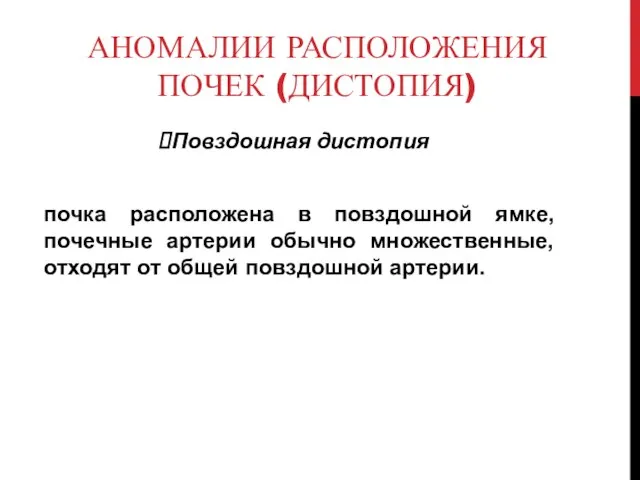 АНОМАЛИИ РАСПОЛОЖЕНИЯ ПОЧЕК (ДИСТОПИЯ) Повздошная дистопия почка расположена в повздошной ямке,