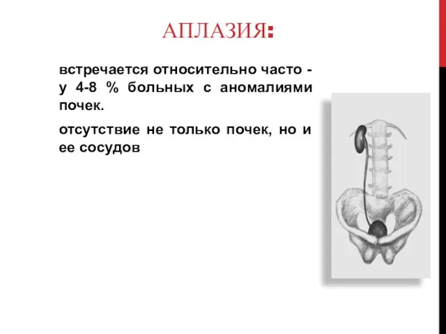 АПЛАЗИЯ: встречается относительно часто - у 4-8 % больных с аномалиями