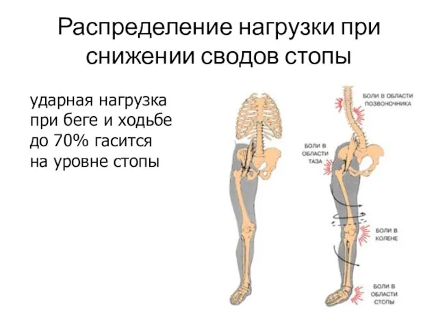 Распределение нагрузки при снижении сводов стопы ударная нагрузка при беге и