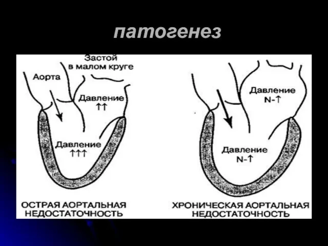 патогенез