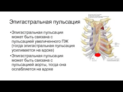 Эпигастральная пульсация Эпигастральная пульсация может быть связана с пульсацией увеличенного ПЖ