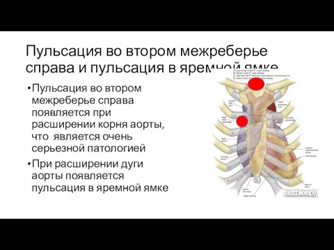 Пульсация во втором межреберье справа и пульсация в яремной ямке Пульсация