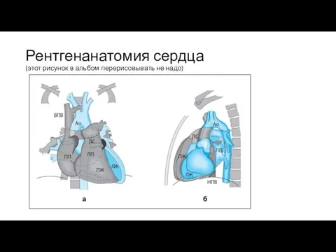 Рентгенанатомия сердца (этот рисунок в альбом перерисовывать не надо)