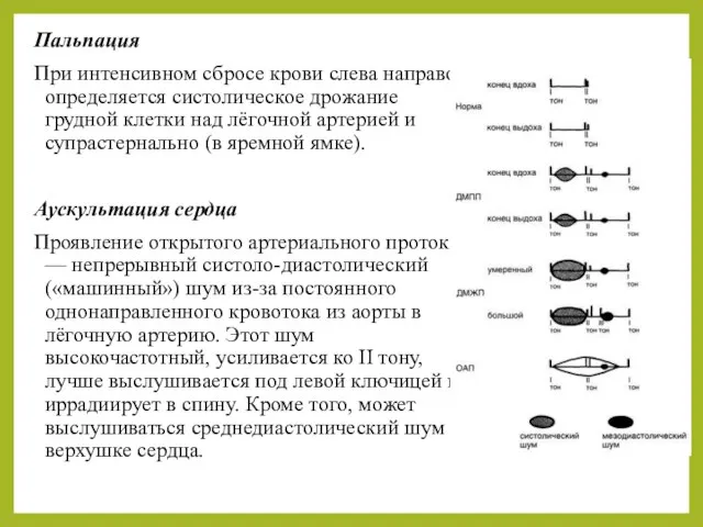 Пальпация При интенсивном сбросе крови слева направо определяется систолическое дрожание грудной