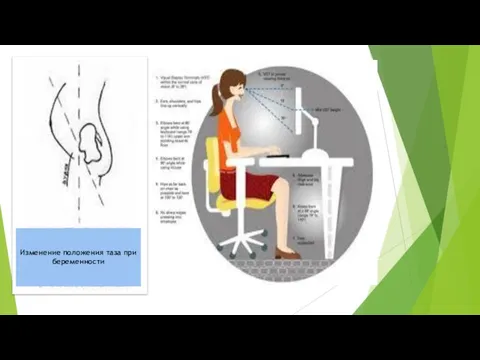 Изменение положения таза при беременности
