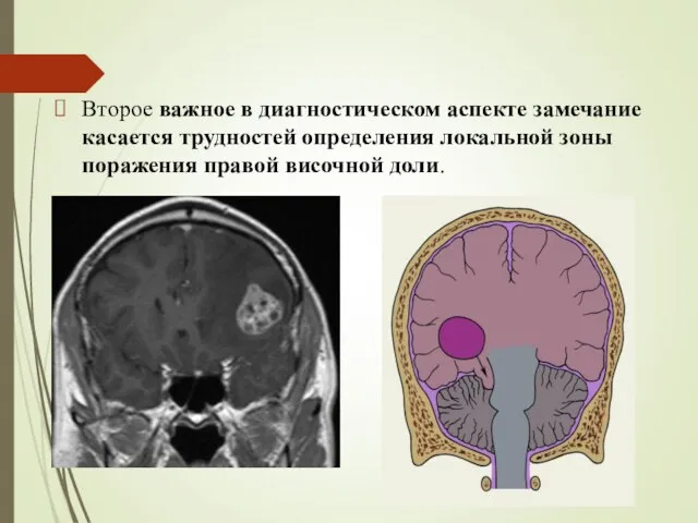 Второе важное в диагностическом аспекте замечание касается трудностей определения локальной зоны поражения правой височной доли.