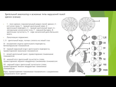 1 - поля зрения; горизонтальный разрез полей зрения; 2 - сетчатка