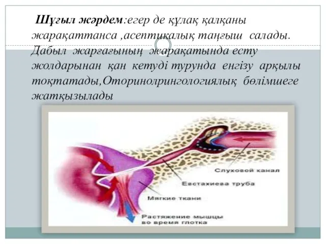 Шұғыл жәрдем:егер де құлақ қалқаны жарақаттанса ,асептикалық таңғыш салады.Дабыл жарғағының жарақатында