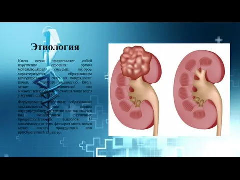 Этиология Киста почки представляет собой нарушение строения органа мочевыводящей системы, которое