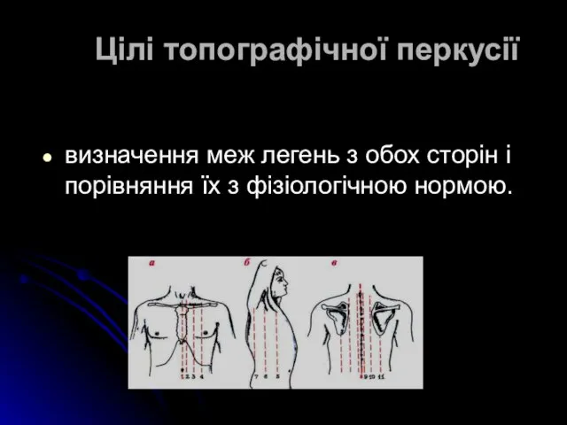 визначення меж легень з обох сторін і порівняння їх з фізіологічною нормою. Цілі топографічної перкусії