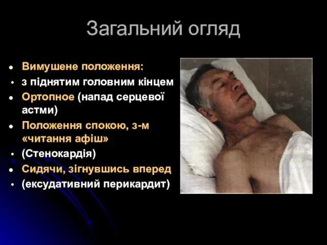 Загальний огляд Вимушене положення: з піднятим головним кінцем Ортопное (напад серцевої