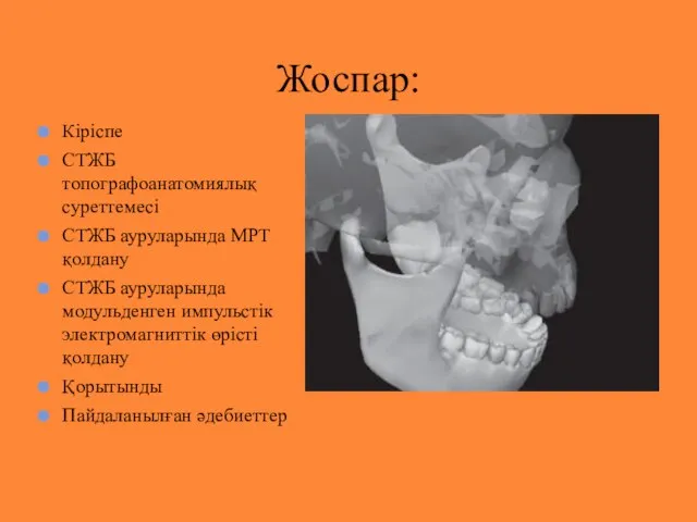 Кіріспе СТЖБ топографоанатомиялық суреттемесі СТЖБ ауруларында МРТ қолдану СТЖБ ауруларында модульденген