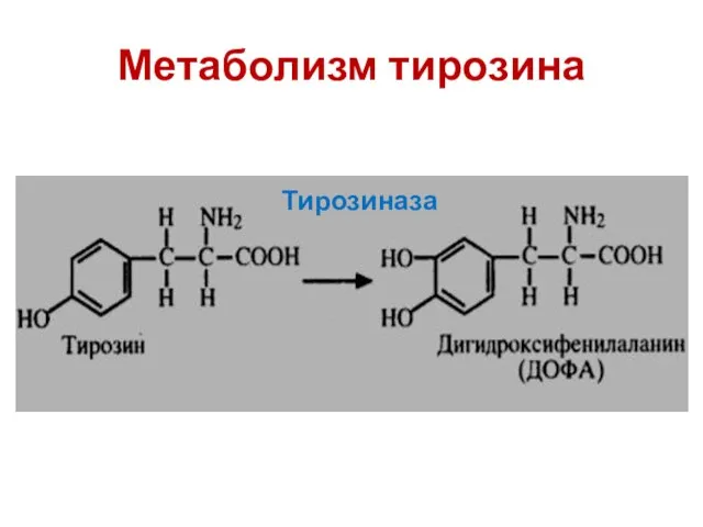 Метаболизм тирозина Тирозиназа