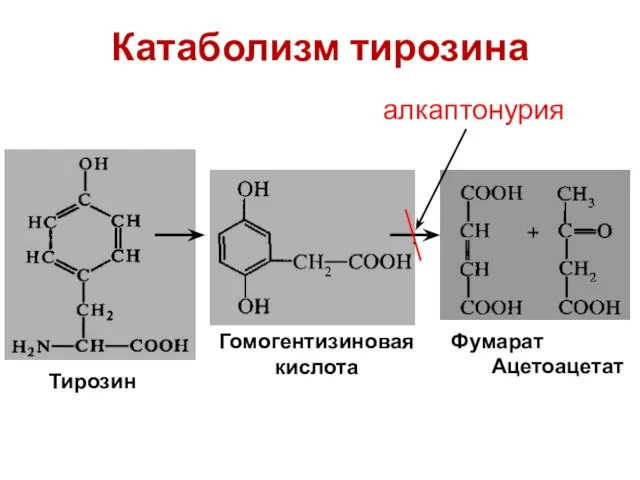 Катаболизм тирозина Гомогентизиновая кислота Фумарат Ацетоацетат Тирозин алкаптонурия