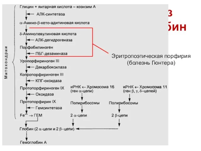 Синтез гемоглобина Эритропоэтическая порфирия (болезнь Гюнтера)