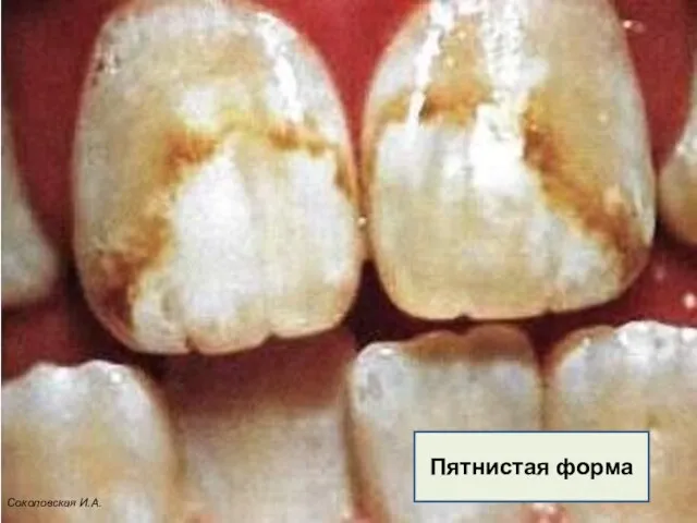 Пятнистая форма Соколовская И.А.