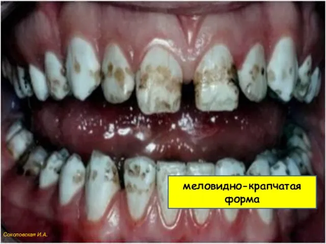 меловидно-крапчатая форма Соколовская И.А.