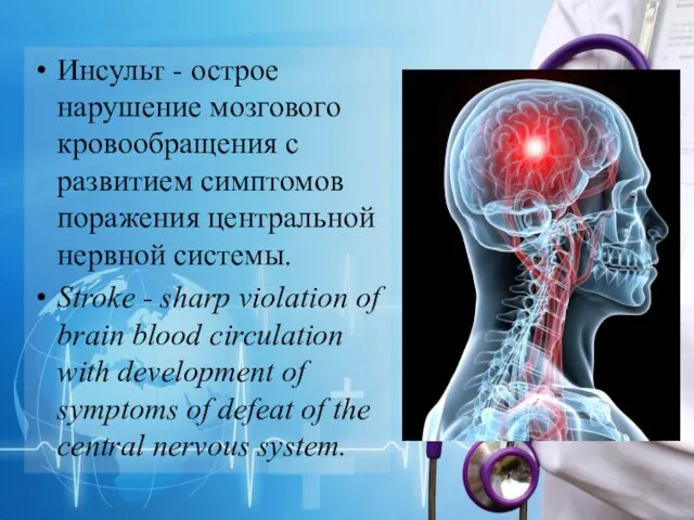 Инсульт - острое нарушение мозгового кровообращения с развитием симптомов поражения центральной