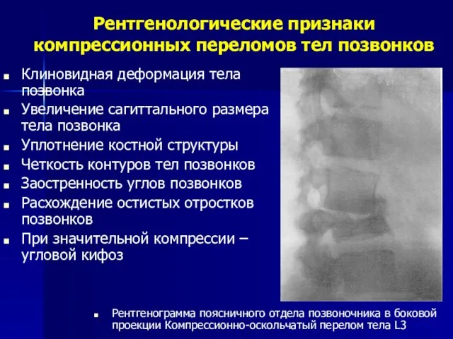 Рентгенологические признаки компрессионных переломов тел позвонков Клиновидная деформация тела позвонка Увеличение