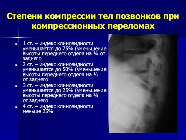 Степени компрессии тел позвонков при компрессионных переломах 1 ст. – индекс