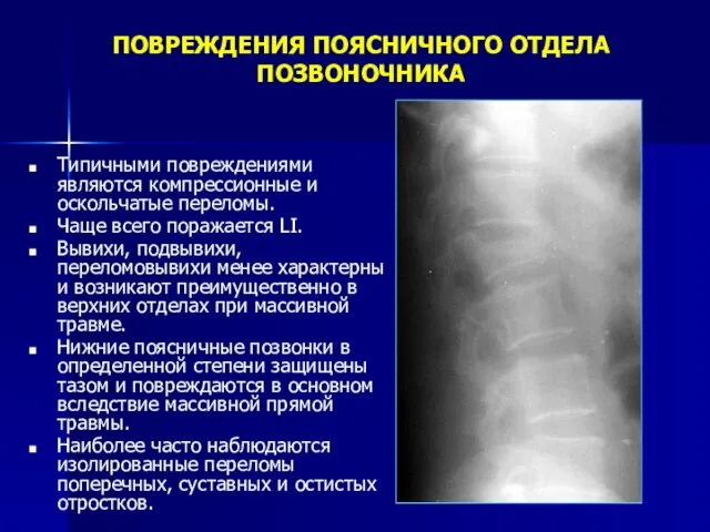 ПОВРЕЖДЕНИЯ ПОЯСНИЧНОГО ОТДЕЛА ПОЗВОНОЧНИКА Типичными повреждениями являются компрессионные и оскольчатые переломы.