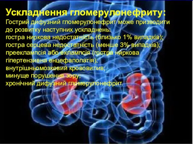 Ускладнення гломерулонефриту: Гострий дифузний гломерулонефрит може призводити до розвитку наступних ускладнень: