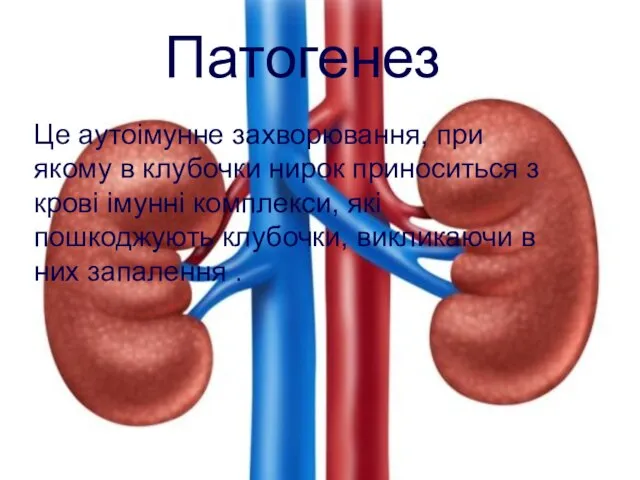 Це аутоімунне захворювання, при якому в клубочки нирок приноситься з крові