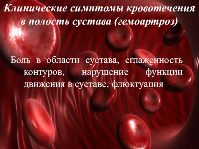 Клинические симптомы кровотечения в полость сустава (гемоартроз) Боль в области сустава,