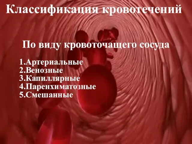 Классификация кровотечений По виду кровоточащего сосуда 1.Артериальные 2.Венозные 3.Капиллярные 4.Паренхиматозные 5.Смешанные