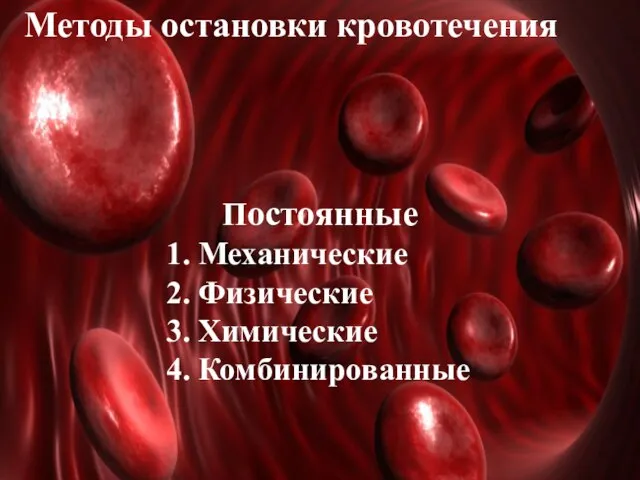 Методы остановки кровотечения Постоянные 1. Механические 2. Физические 3. Химические 4. Комбинированные