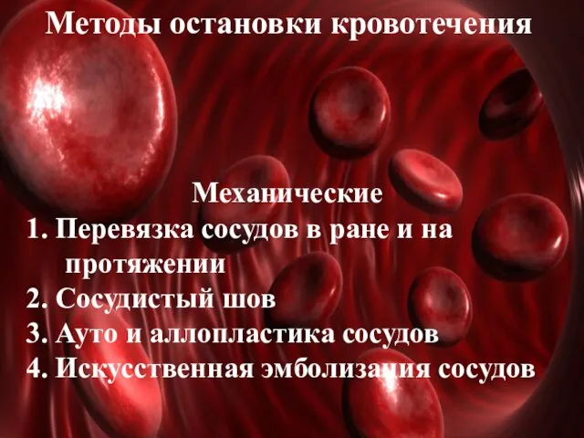 Методы остановки кровотечения Механические 1. Перевязка сосудов в ране и на