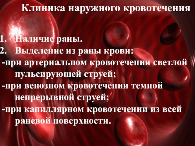 Клиника наружного кровотечения Наличие раны. Выделение из раны крови: -при артериальном