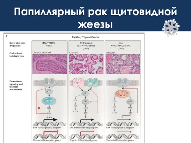 Папиллярный рак щитовидной жеезы