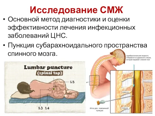 Исследование СМЖ Основной метод диагностики и оценки эффективности лечения инфекционных заболеваний