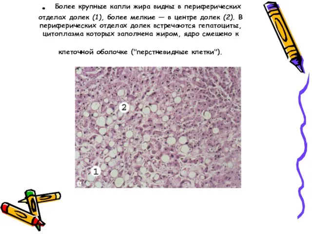 . Более крупные капли жира видны в периферических отделах долек (1),