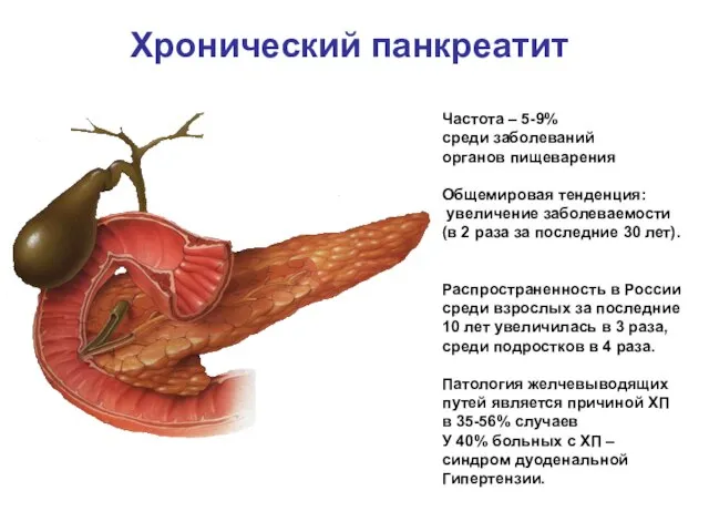 Хронический панкреатит Частота – 5-9% среди заболеваний органов пищеварения Общемировая тенденция: