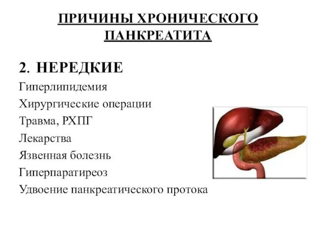 ПРИЧИНЫ ХРОНИЧЕСКОГО ПАНКРЕАТИТА 2. НЕРЕДКИЕ Гиперлипидемия Хирургические операции Травма, РХПГ Лекарства