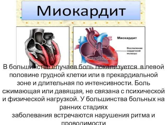 В большинстве случаев боль локализуется в левой половине грудной клетки или