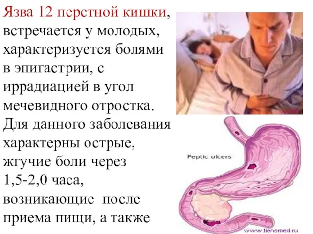 Язва 12 перстной кишки, встречается у молодых, характеризуется болями в эпигастрии,