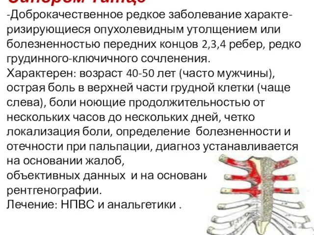 Синдром Титце -Доброкачественное редкое заболевание характе-ризирующиеся опухолевидным утолщением или болезненностью передних