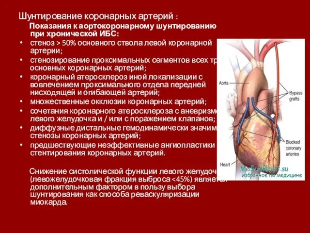 Шунтирование коронарных артерий : Показания к аортокоронарному шунтированию при хронической ИБС:
