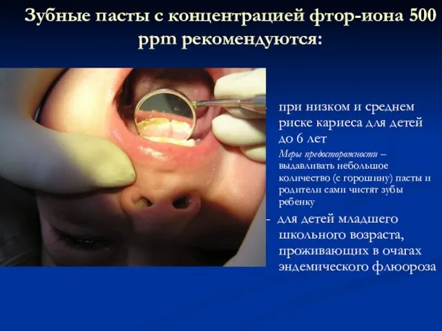 Зубные пасты с концентрацией фтор-иона 500 ppm рекомендуются: при низком и