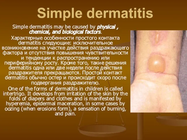 Simple dermatitis Simple dermatitis may be caused by physical , chemical,