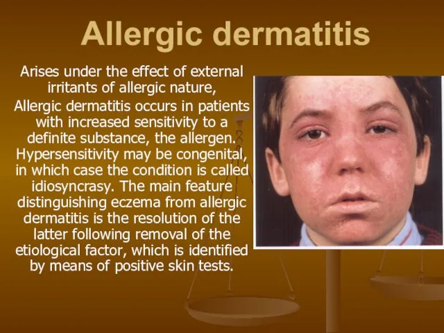 Allergic dermatitis Arises under the effect of external irritants of allergic