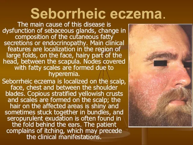 Seborrheic eczema. The main cause of this disease is dysfunction of