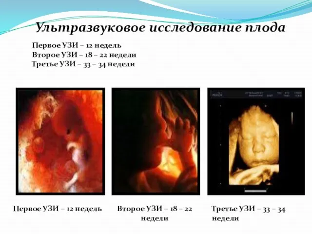 Ультразвуковое исследование плода Первое УЗИ – 12 недель Второе УЗИ –