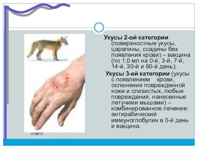 Укусы 2-ой категории (поверхностные укусы, царапины, ссадины без появления крови) –