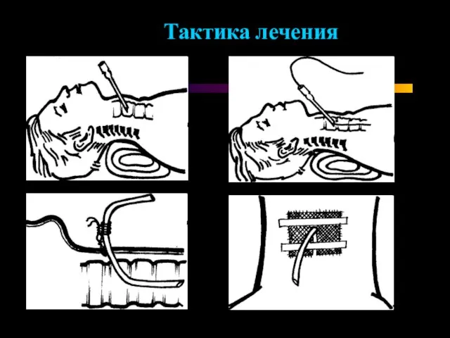 Тактика лечения