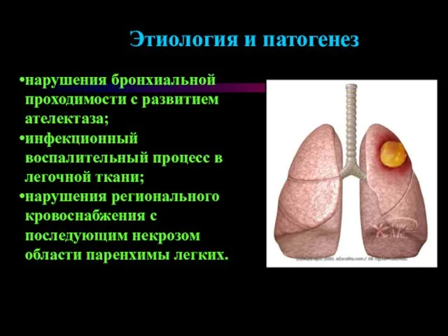 Этиология и патогенез нарушения бронхиальной проходимости с развитием ателектаза; инфекционный воспалительный