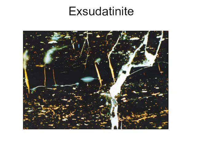 Exsudatinite